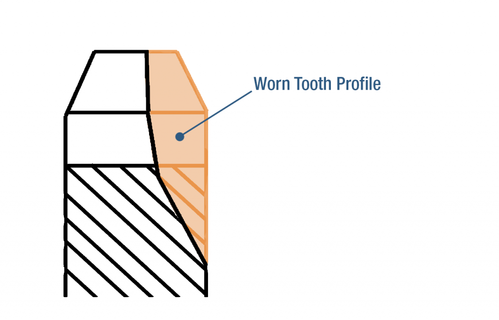 Profilo del dente usurato